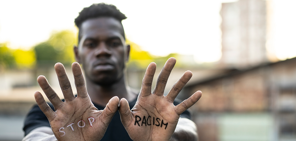 Black man holding up open palms with the words ‘stop racism’ written on them.